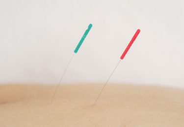 針を刺すのが怖い方必見　刺さない鍼治療