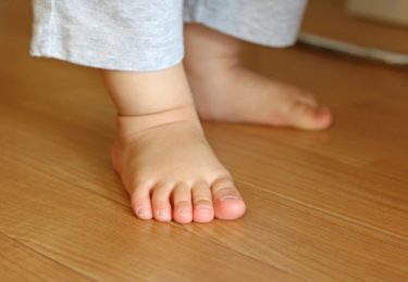 他の子よりも疲れやすい？子どもの扁平足どうすれば